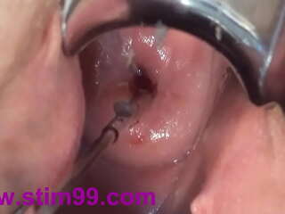 Cervix fucking play deep japanese asian - å­å®®é ¸éƒ¨ã‚¯ã‚½